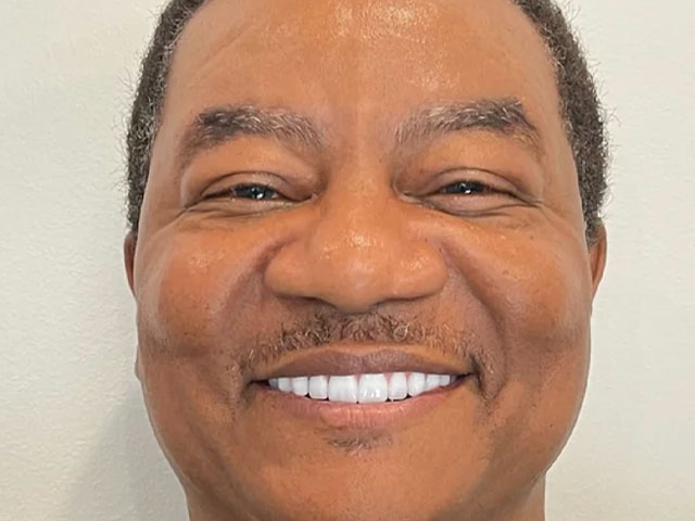 case 10 dental implants after