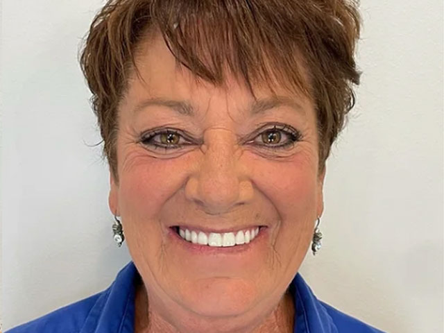 case 5 dental implants after