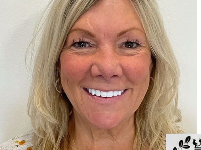 case 6 dental implants after