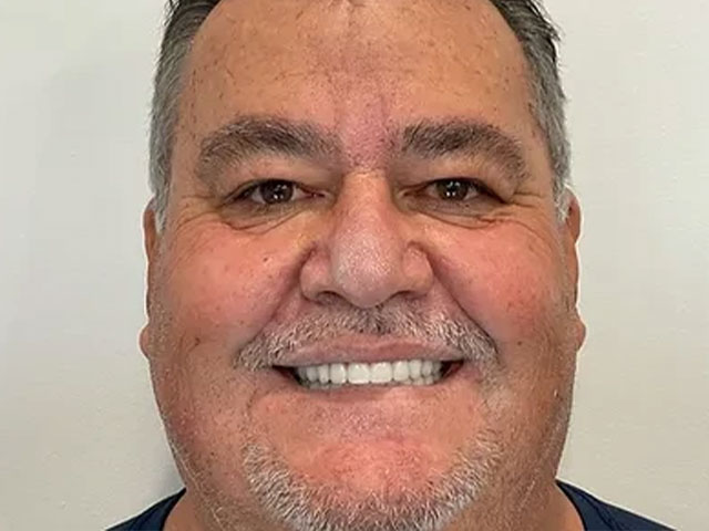 case 7 dental implants after