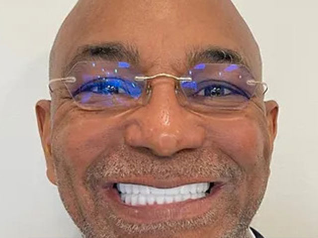 case 8 dental implants after