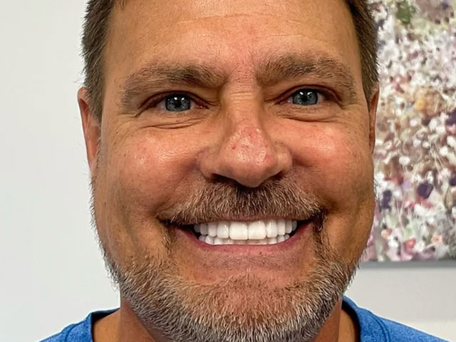 case 9 dental implants after