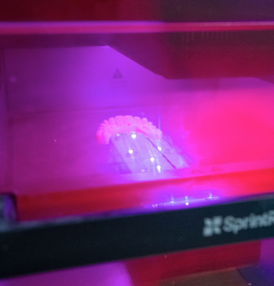 sprint ray dental lab